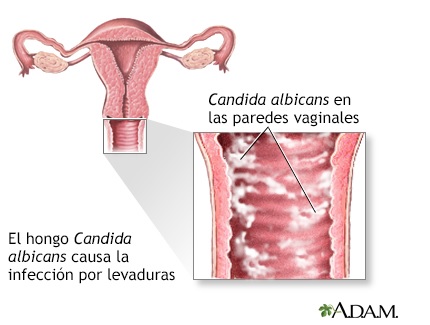 candida-albicans